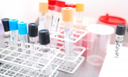 Scope/Authority to Order Challenges