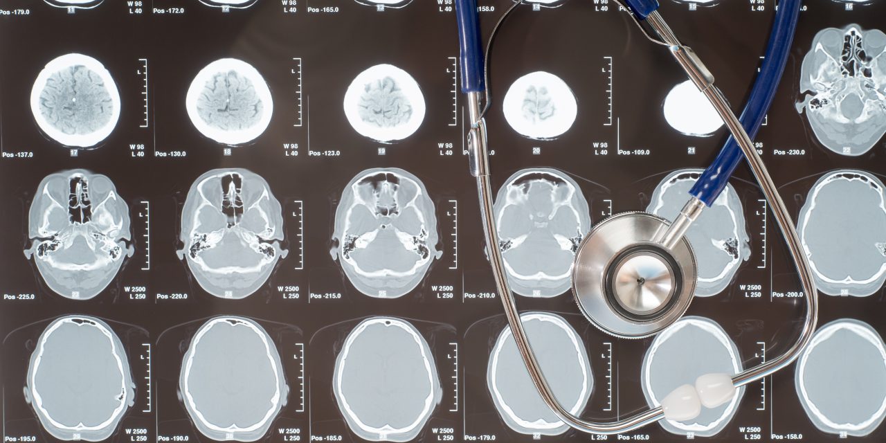 Common Neurological Disorders