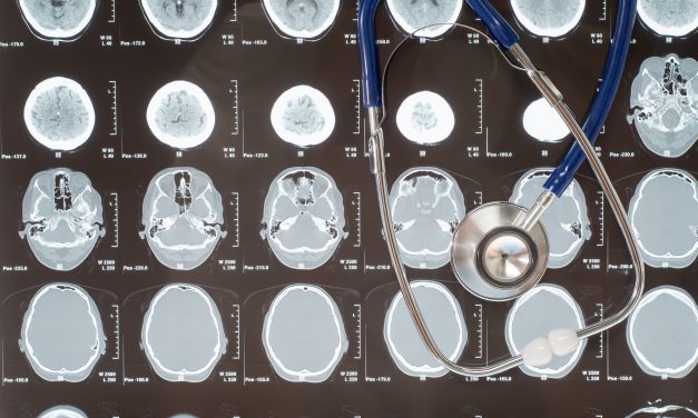 Common Neurological Disorders