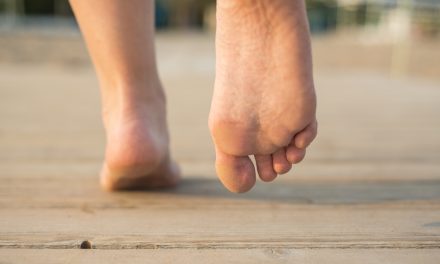 Callus Management with Orthotic Support