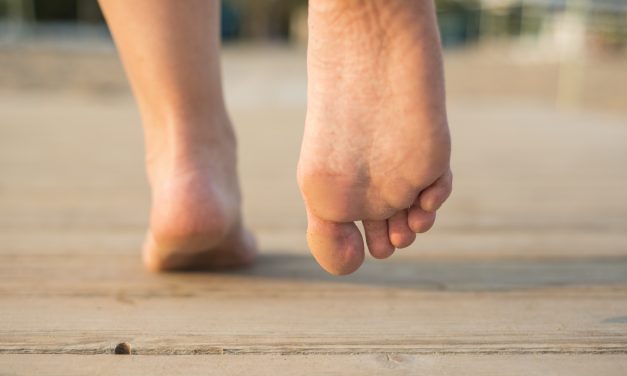 Callus Management with Orthotic Support