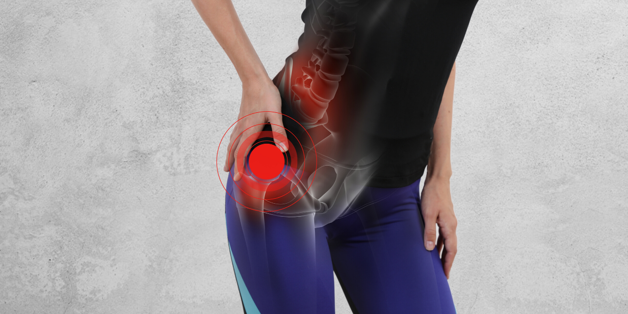 Maigne Syndrome: Sciatica of the Thoraco-Lumbar Junction