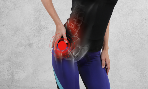 Maigne Syndrome: Sciatica of the Thoraco-Lumbar Junction