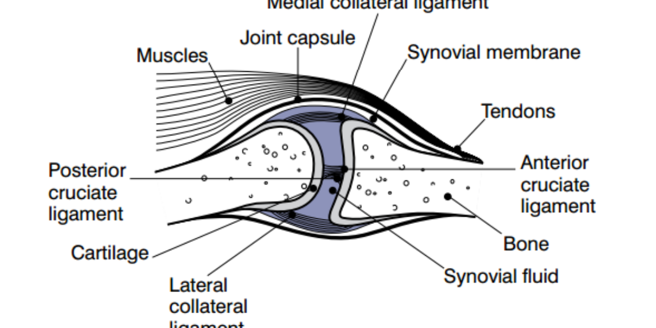Loose Body Formation Associated with Degenerative Joint Disease and as a Primary Disorder