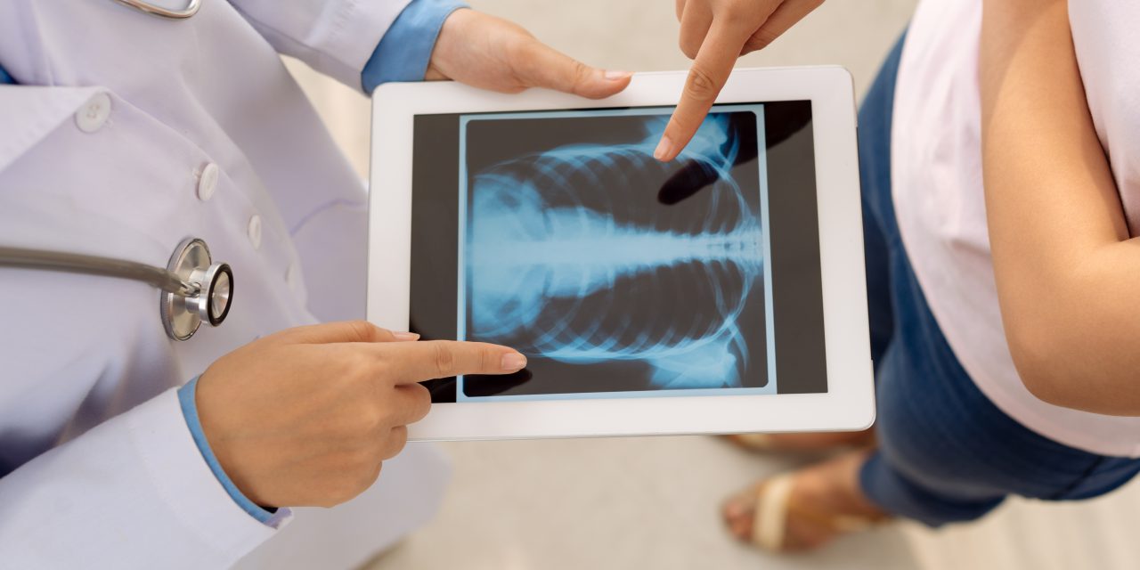 Radiography of Viral or Secondary Bacterial Pneumonia
