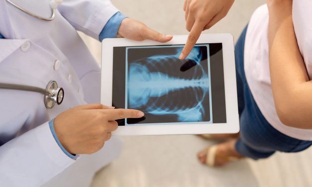 Radiography of Viral or Secondary Bacterial Pneumonia