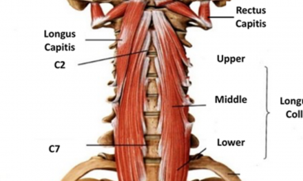 The Most Overlooked Cause of Neck Pain