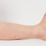 10 Facts Every DC Should Know About Leg Length Discrepancy