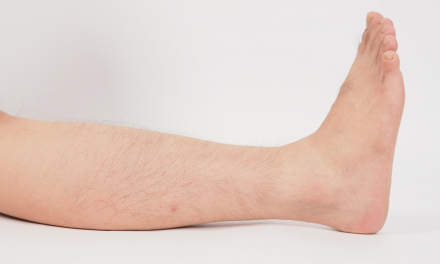 10 Facts Every DC Should Know About Leg Length Discrepancy