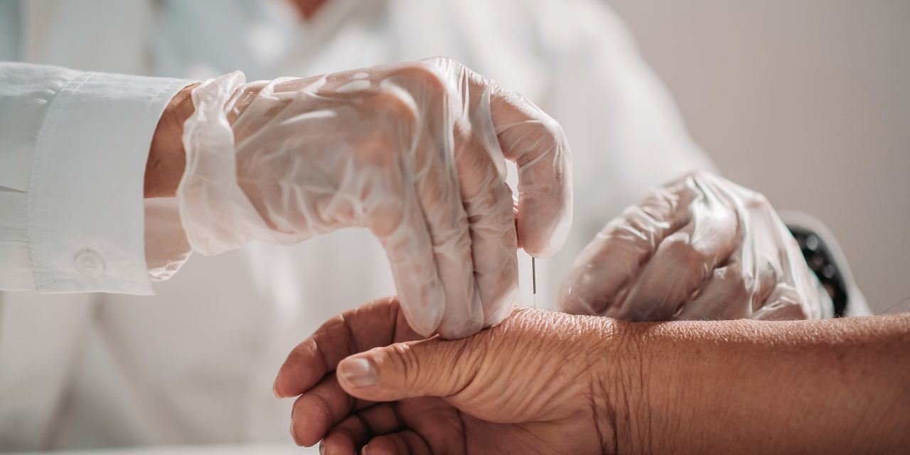 Medicare Acupuncture Coverage Requirements for Chiropractic Physicians in Illinois