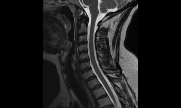 What To Order And When: An Overview Of Ordering Advanced Imaging For Musculoskeletal Conditions Specific To The Chiropractic Office