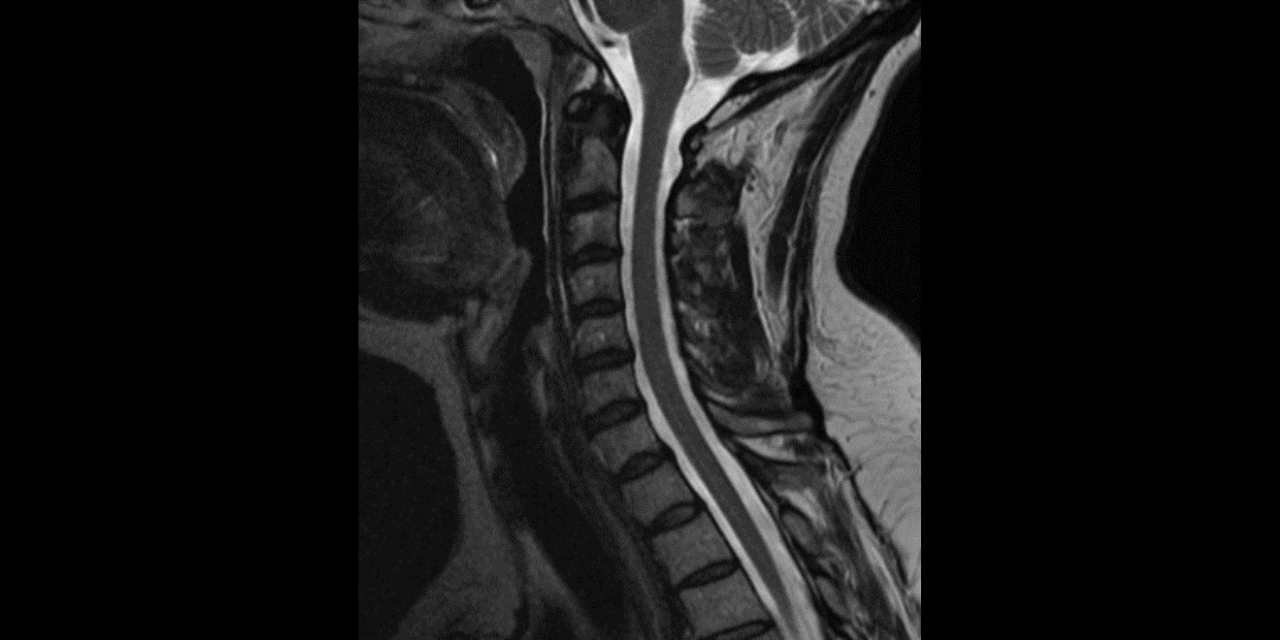 What To Order And When: An Overview Of Ordering Advanced Imaging For Musculoskeletal Conditions Specific To The Chiropractic Office